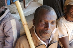 june-2019-medical-outreach-man-with-tumor-removed