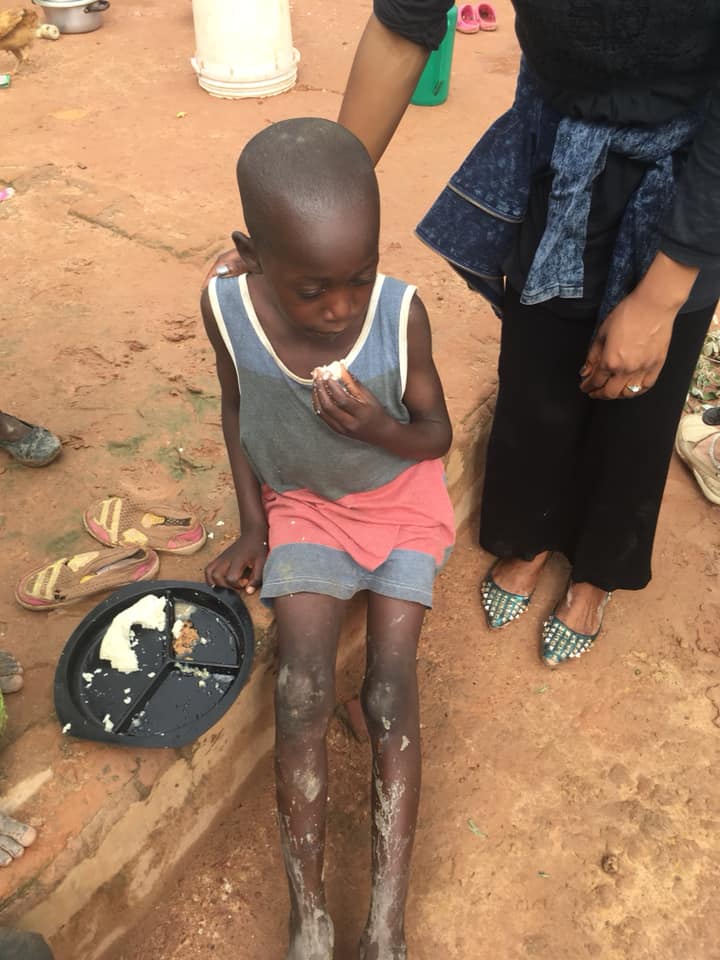 malnourished child at feeding program